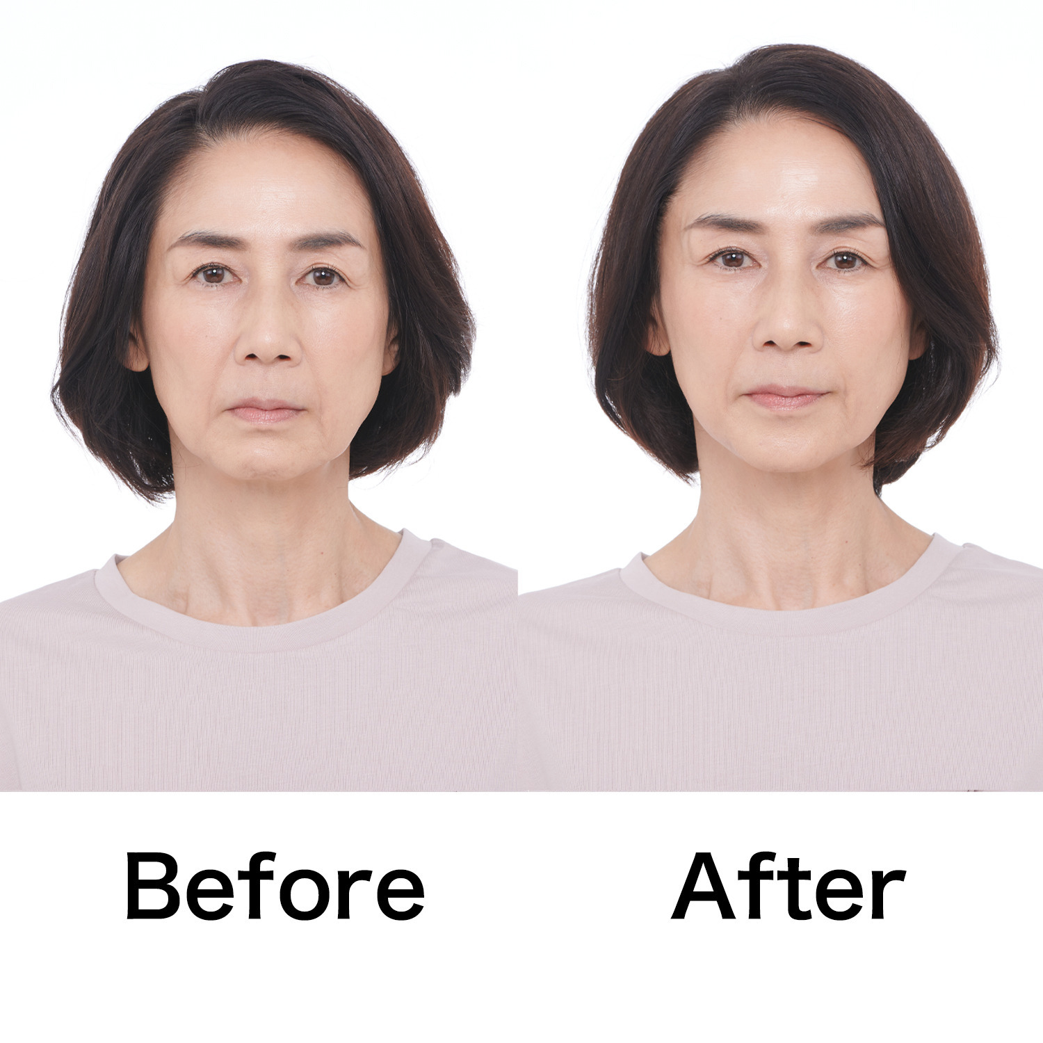 タイムレス 簡単装着で 目元・フェイスラインを 引き上げる！ スマイルクリップ