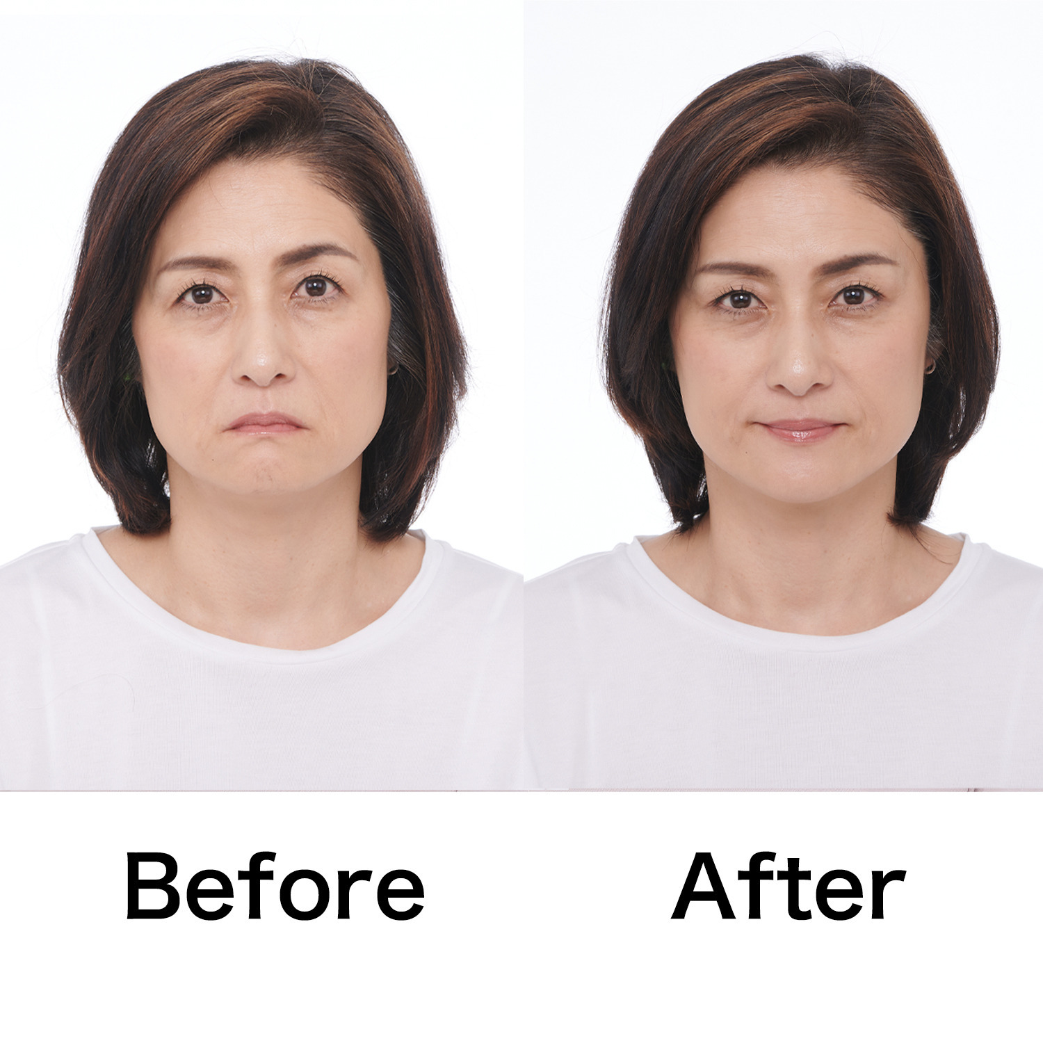 タイムレス 簡単装着で 目元・フェイスラインを 引き上げる！ スマイルクリップ