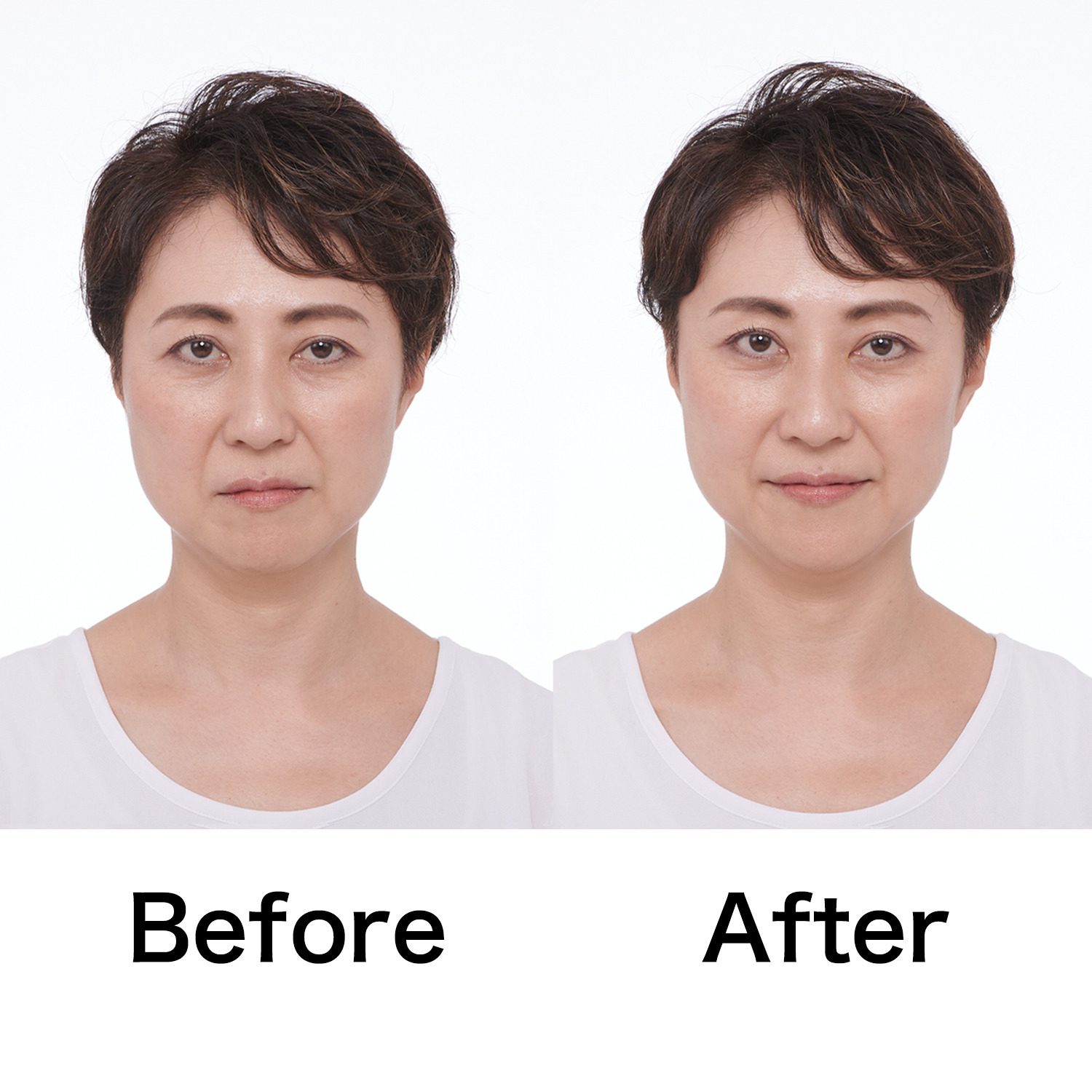 タイムレス 簡単装着で 目元・フェイスラインを 引き上げる！ スマイルクリップ