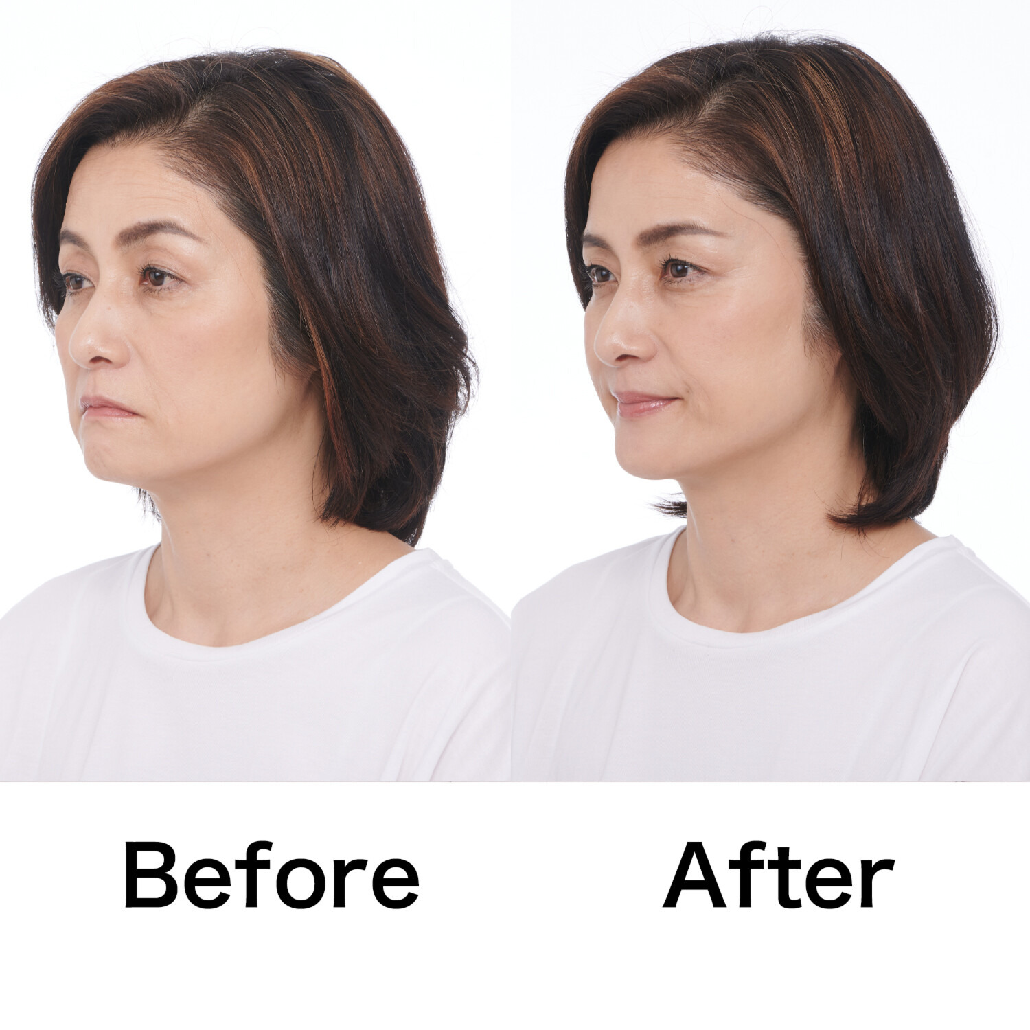 タイムレス 簡単装着で 目元・フェイスラインを 引き上げる！ スマイルクリップ