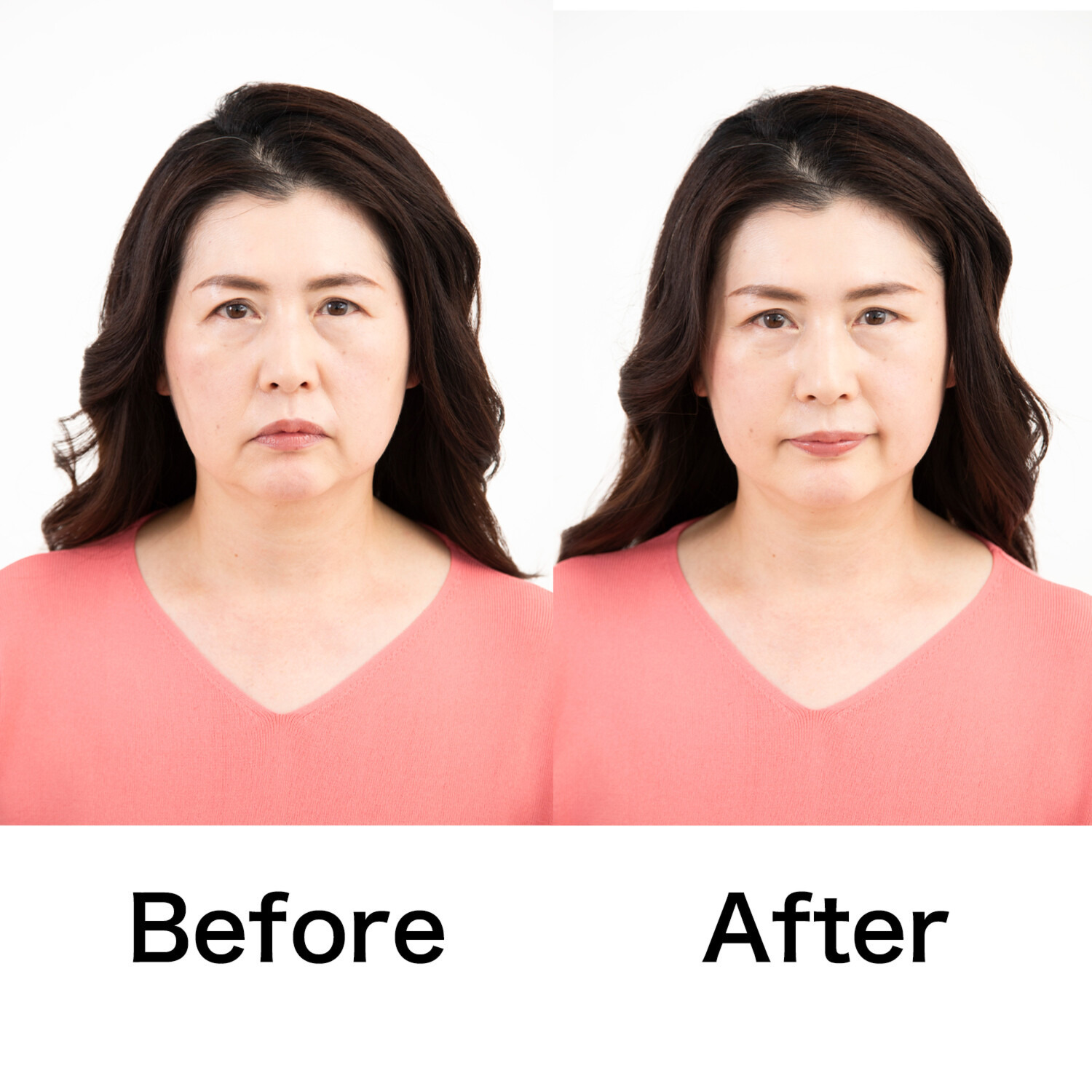 タイムレス 簡単装着で 目元・フェイスラインを 引き上げる！ スマイルクリップ