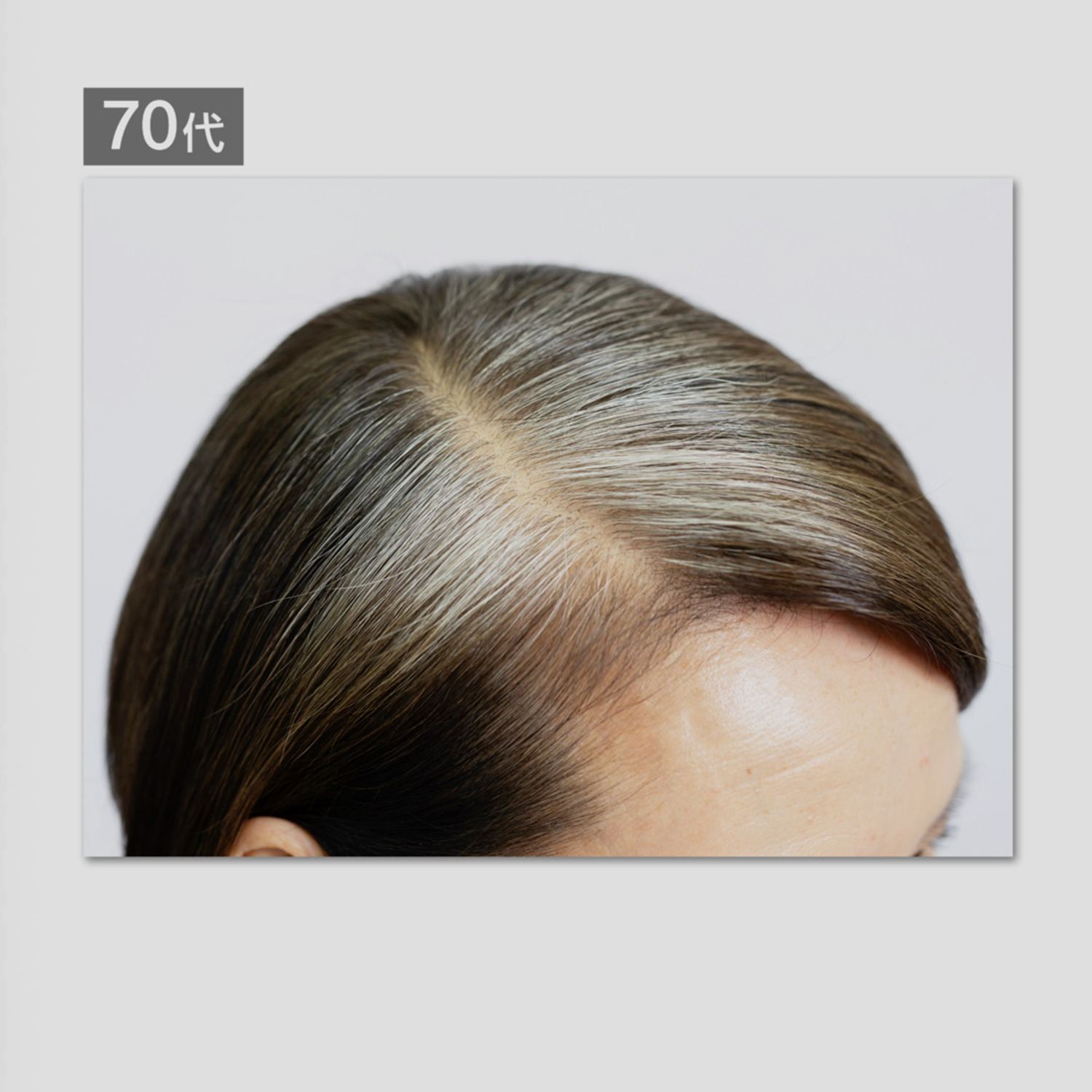 ララチュー デビュー５周年 メイク効果で薄毛と白髪を 簡単瞬時にカバー ヘアファンデーション プレミアムＥＸ ＜ダークブラウン＞ ２個分スペシャルセット