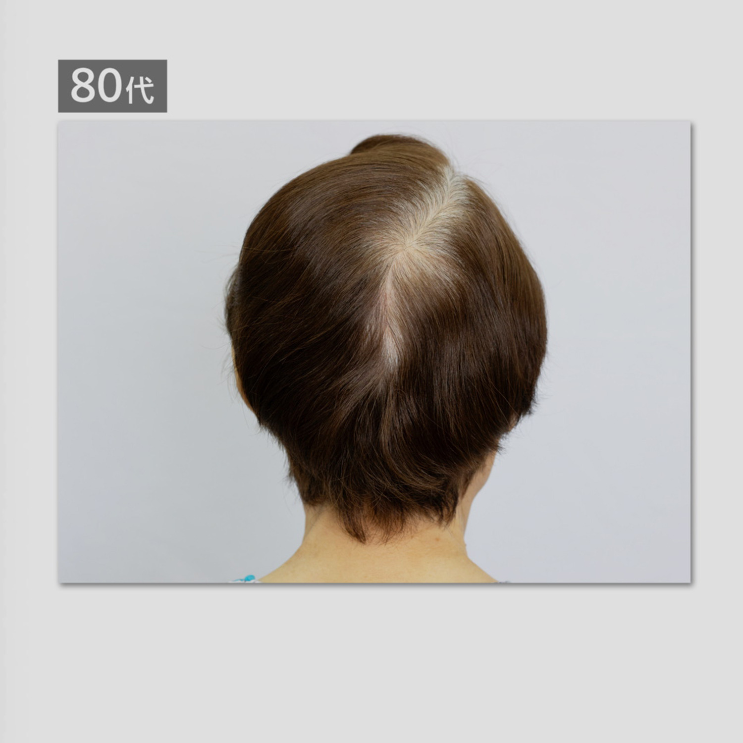 ララチュー デビュー５周年 メイク効果で薄毛と白髪を 簡単瞬時にカバー ヘアファンデーション プレミアムＥＸ ＜ダークブラウン＞ ２個分スペシャルセット