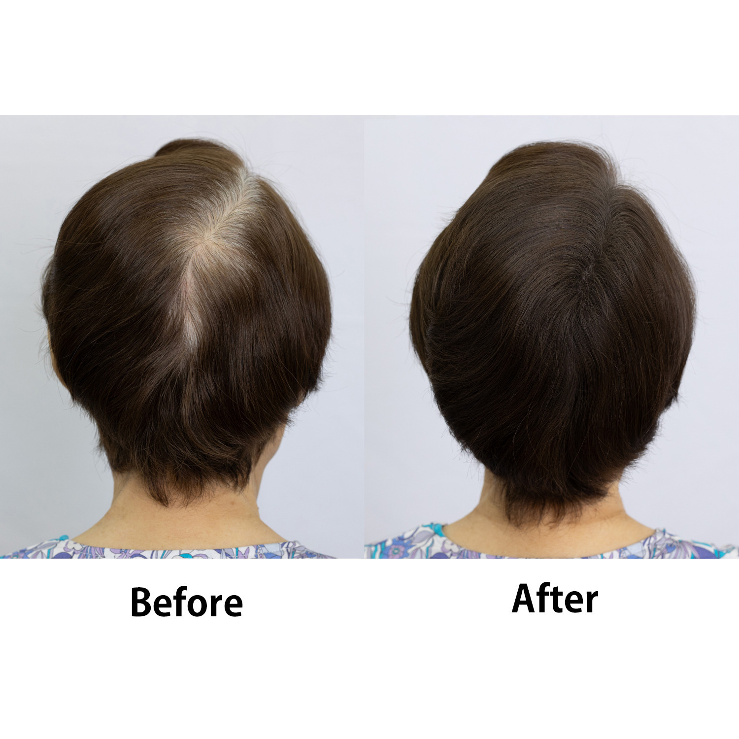 ララチュー デビュー６周年 メイク効果で薄毛と白髪を 簡単瞬時にカバー ヘアファンデーション プレミアムＥＸ ＜ダークブラウン＞ ２個分パフ２枚付セット